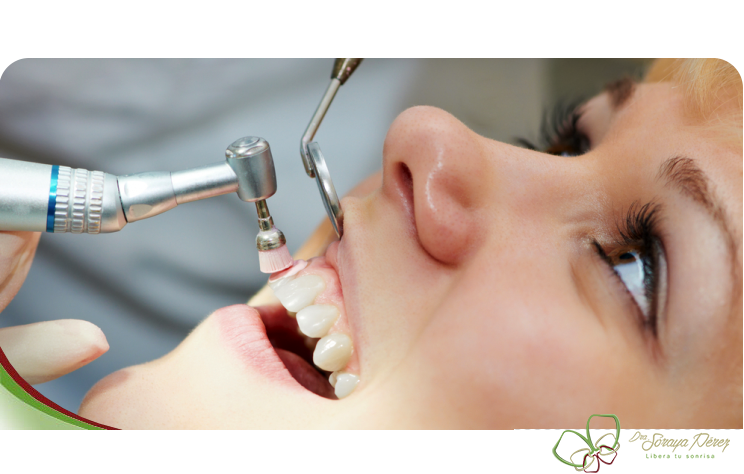 “ultrasonido dental”的图片搜索结果