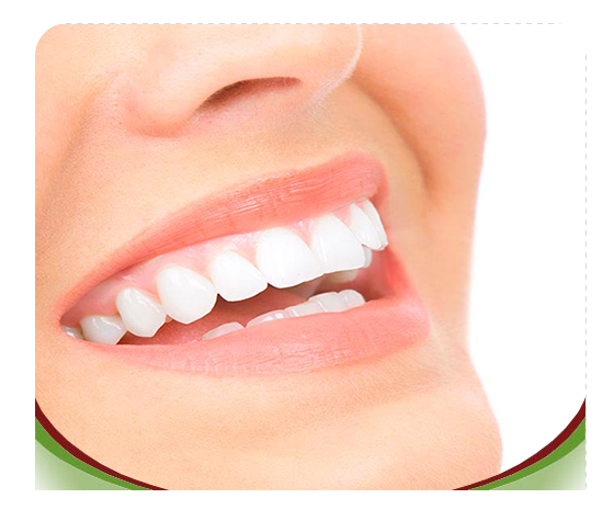 sonrisas perfectas Bucaramanga